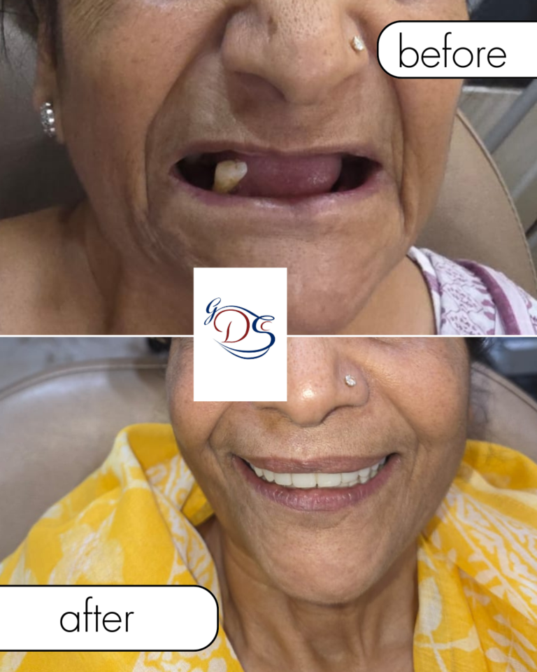 beige minimalist beauty before after collage instagram post 6